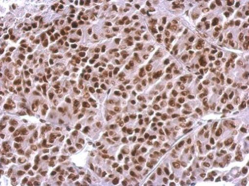 H3R17me2a Antibody in Immunohistochemistry (Paraffin) (IHC (P))