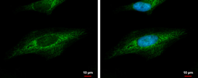 beta Dystroglycan Antibody in Immunocytochemistry (ICC/IF)