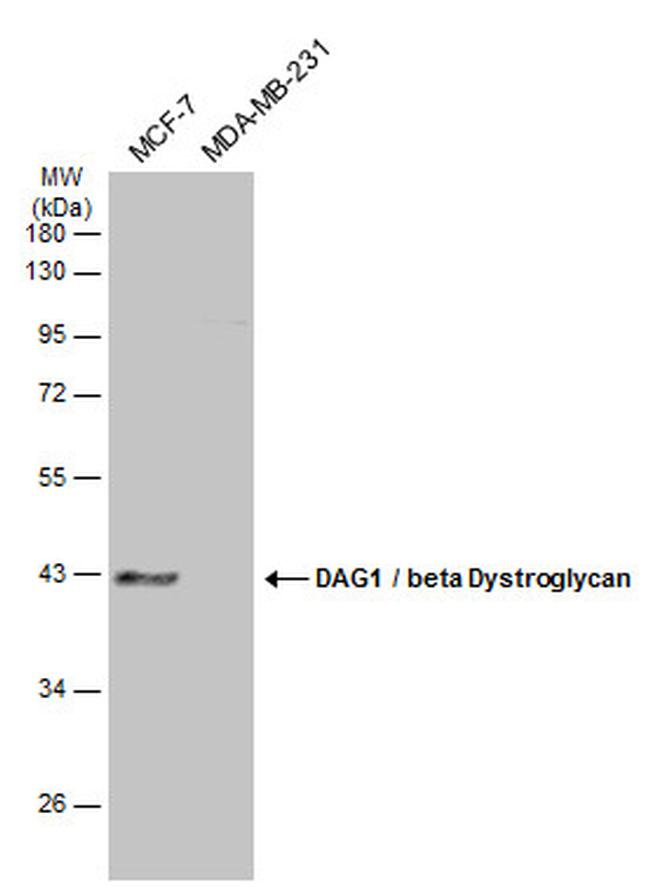 beta Dystroglycan Antibody in Western Blot (WB)