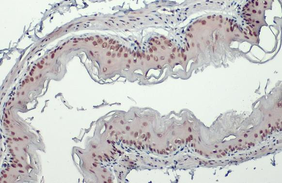 USP7 Antibody in Immunohistochemistry (Paraffin) (IHC (P))