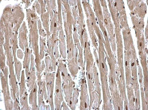 USP7 Antibody in Immunohistochemistry (Paraffin) (IHC (P))