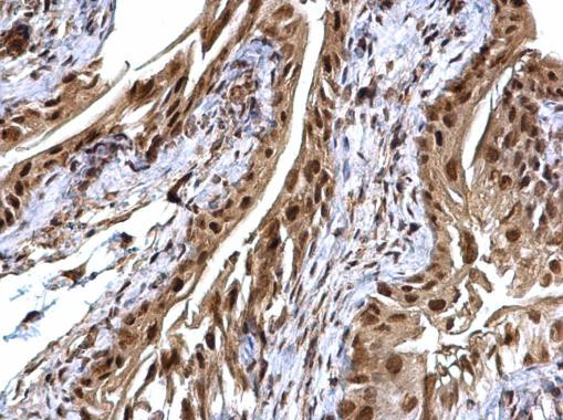 USP7 Antibody in Immunohistochemistry (Paraffin) (IHC (P))