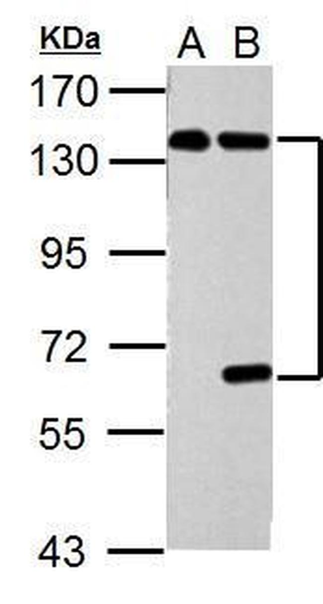 USP7 Antibody in Western Blot (WB)