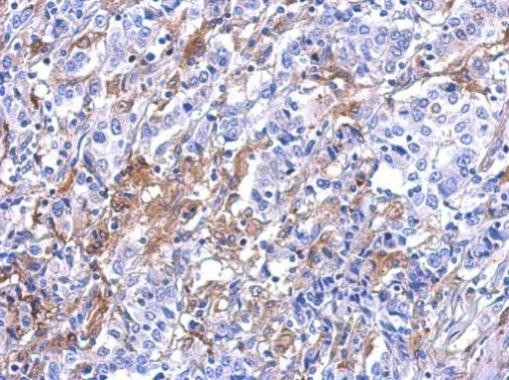 Galectin 3 Antibody in Immunohistochemistry (Paraffin) (IHC (P))