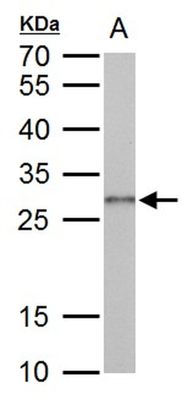 Galectin 3 Antibody in Western Blot (WB)