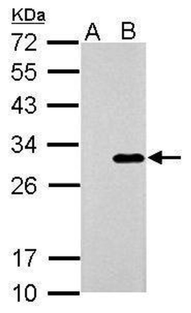 Galectin 3 Antibody in Western Blot (WB)