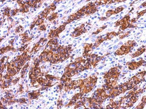 Galectin 4 Antibody in Immunohistochemistry (Paraffin) (IHC (P))