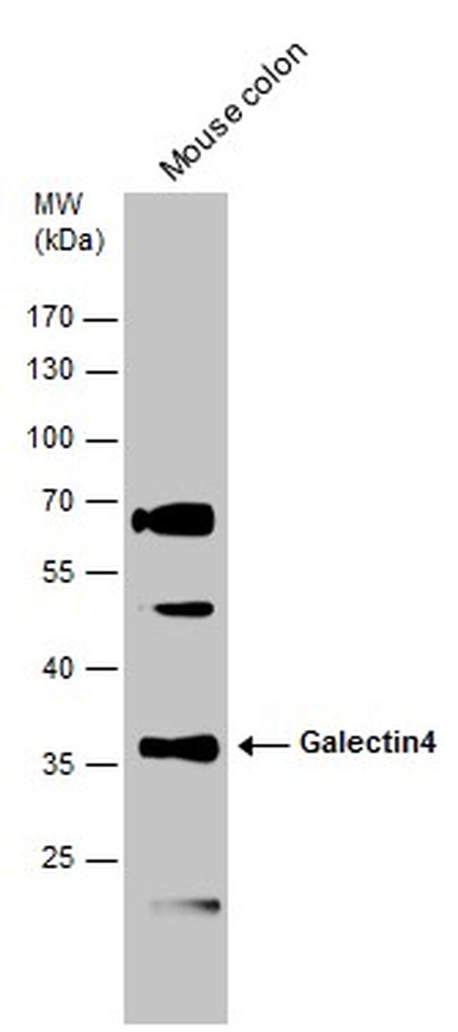 Galectin 4 Antibody in Western Blot (WB)