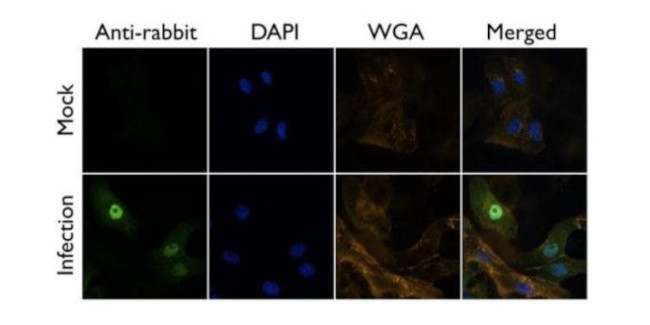 Influenza A PB1 Antibody in Immunocytochemistry (ICC/IF)