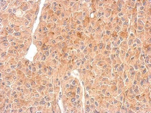 RAD26L Antibody in Immunohistochemistry (Paraffin) (IHC (P))