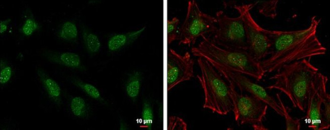 SLU7 Antibody in Immunocytochemistry (ICC/IF)