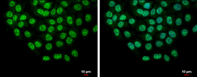 SLU7 Antibody in Immunocytochemistry (ICC/IF)