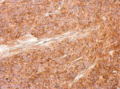 AID Antibody in Immunohistochemistry (Paraffin) (IHC (P))