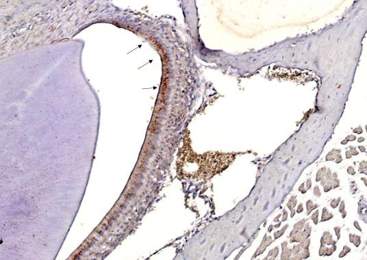 Influenza A H3N2 HA Antibody in Immunohistochemistry (Paraffin) (IHC (P))