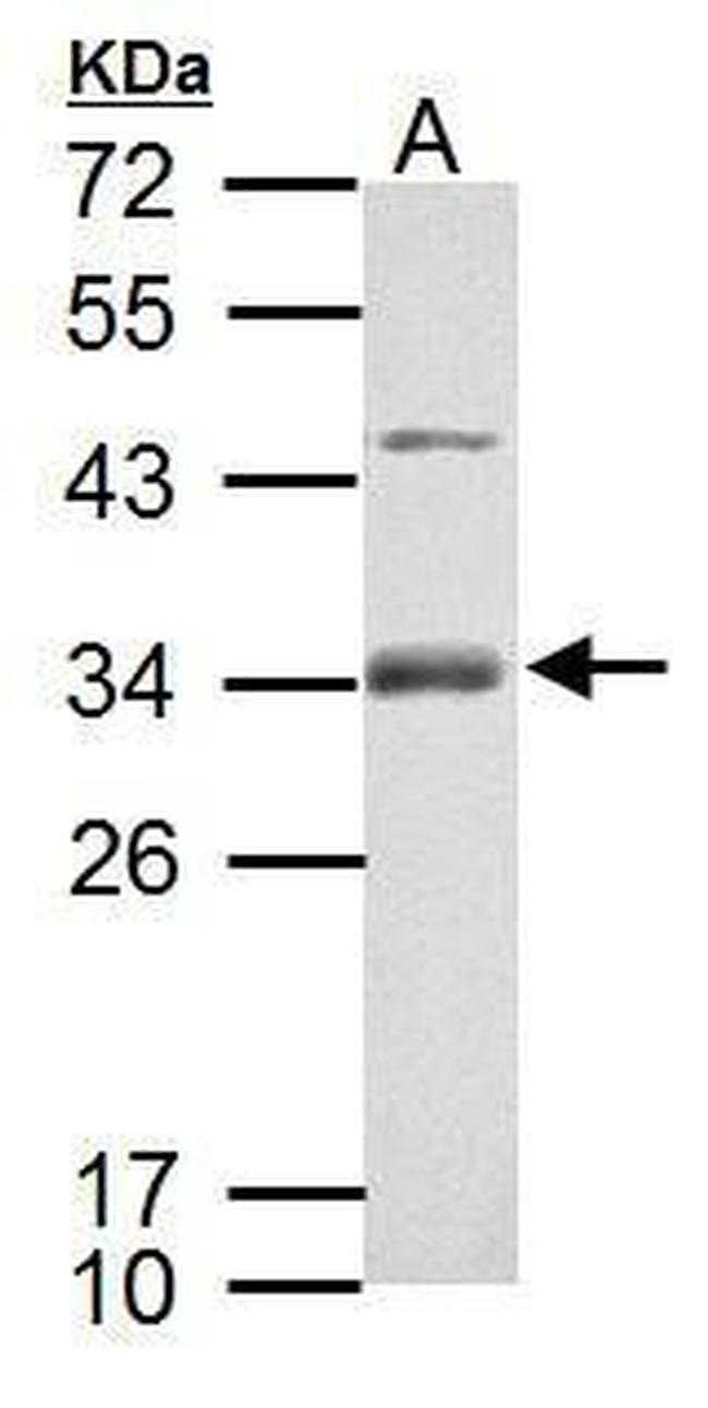 RSPO1 Antibody in Western Blot (WB)