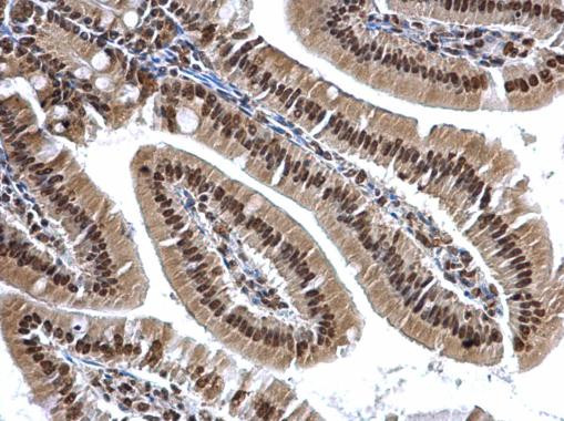 hnRNP A2B1 Antibody in Immunohistochemistry (Paraffin) (IHC (P))