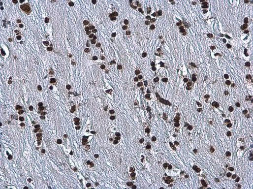 hnRNP A2B1 Antibody in Immunohistochemistry (Paraffin) (IHC (P))