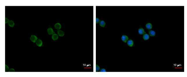 NFATC2 Antibody in Immunocytochemistry (ICC/IF)