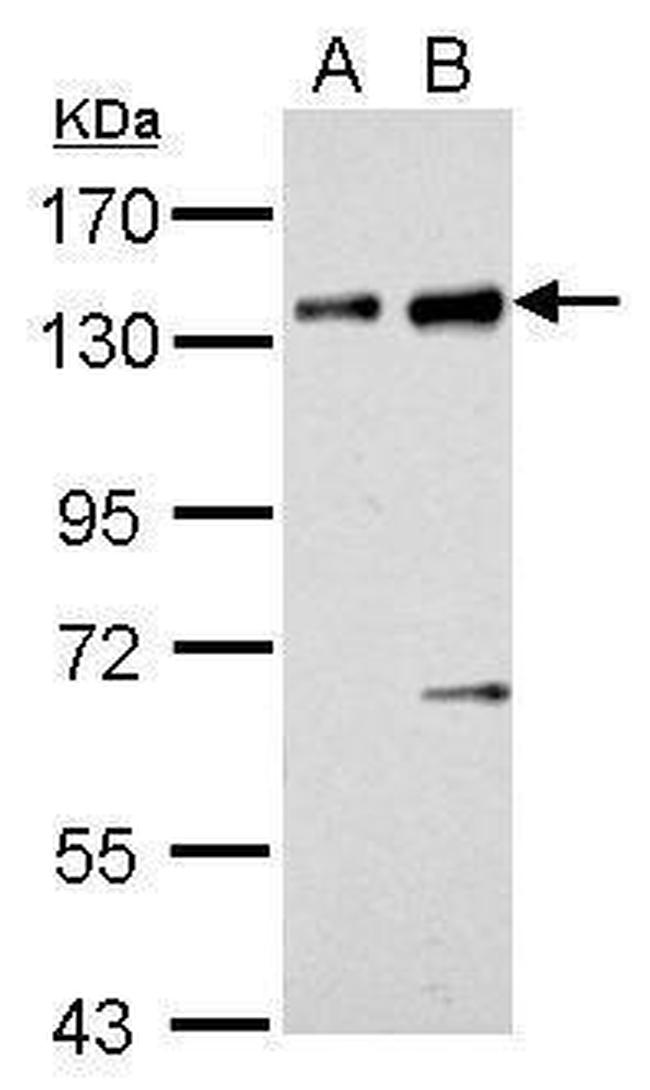 NFATC2 Antibody in Western Blot (WB)