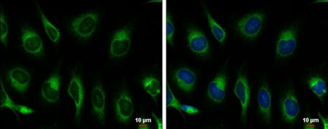 GRP78 Antibody in Immunocytochemistry (ICC/IF)