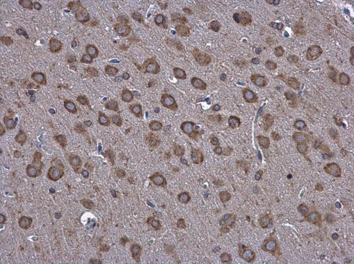 GRP78 Antibody in Immunohistochemistry (Paraffin) (IHC (P))