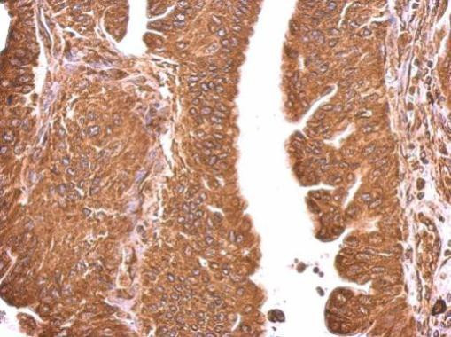 GRP78 Antibody in Immunohistochemistry (Paraffin) (IHC (P))