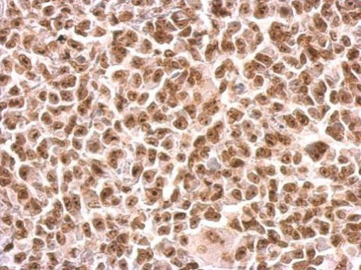 MOK Antibody in Immunohistochemistry (Paraffin) (IHC (P))