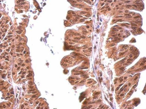 MOK Antibody in Immunohistochemistry (Paraffin) (IHC (P))