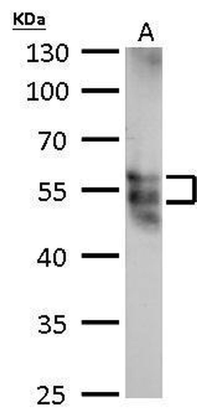 MOK Antibody in Western Blot (WB)