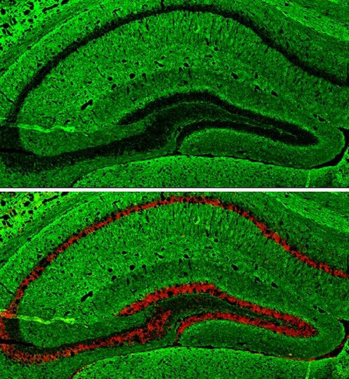 GAP43 Antibody in Immunohistochemistry (Frozen) (IHC (F))