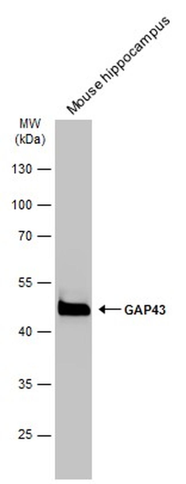 GAP43 Antibody in Western Blot (WB)