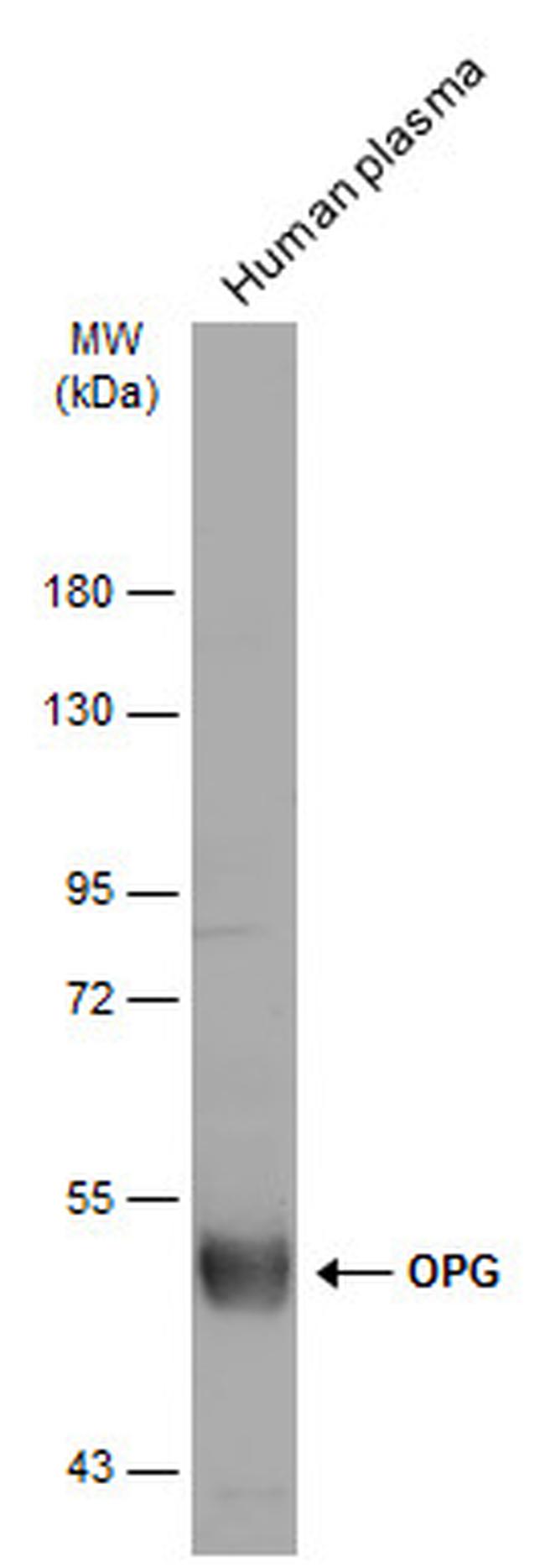 TNFRSF11B Antibody in Western Blot (WB)