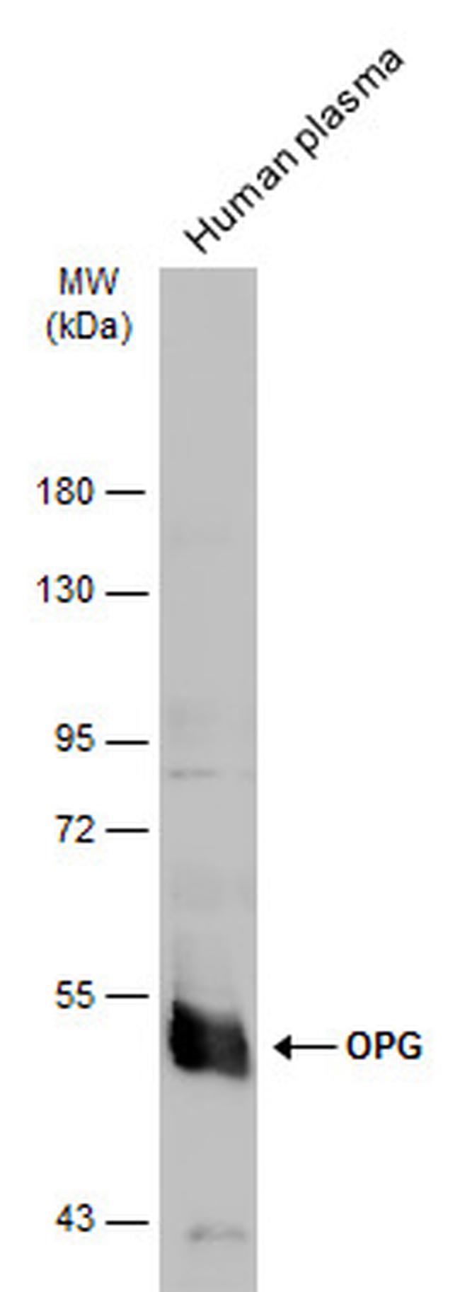 TNFRSF11B Antibody in Western Blot (WB)