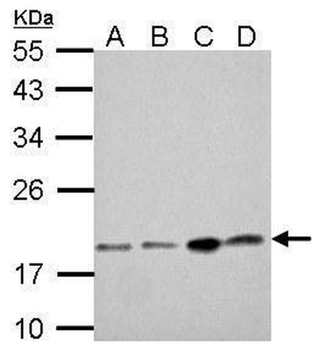 DCTD Antibody in Western Blot (WB)