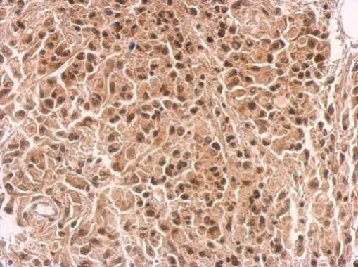 IKZF4 Antibody in Immunohistochemistry (Paraffin) (IHC (P))