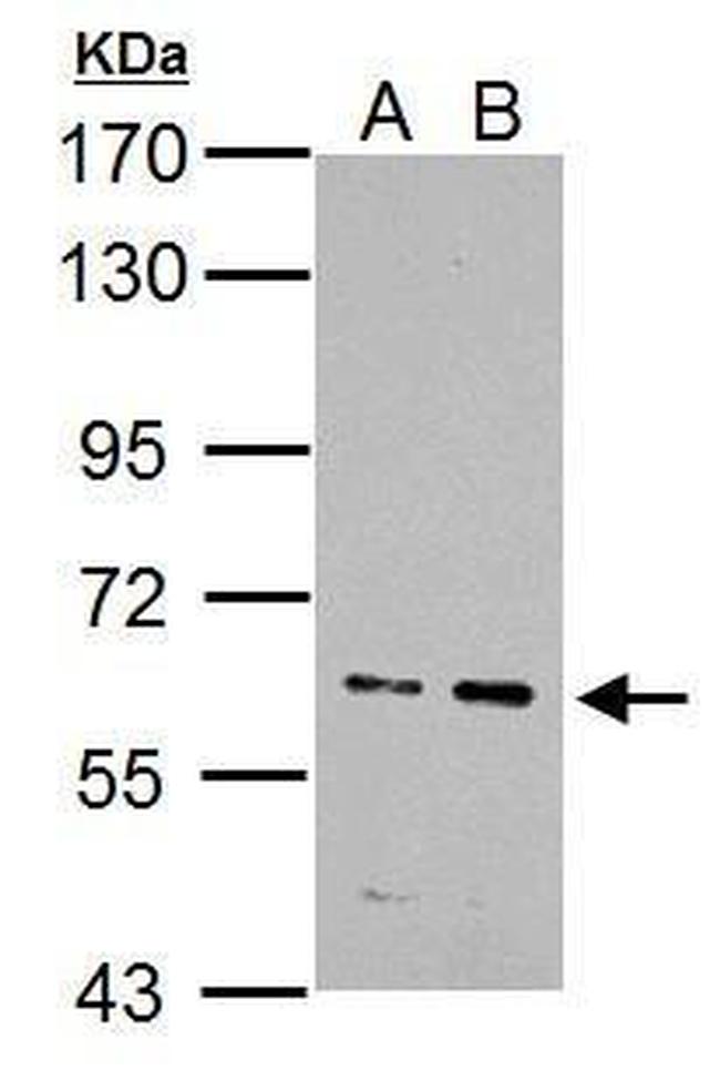 IKZF4 Antibody in Western Blot (WB)