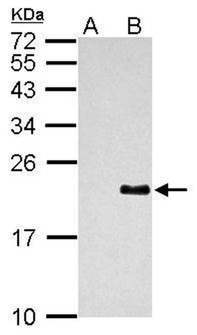 Dengue Virus Type 2 PrM Antibody in Western Blot (WB)