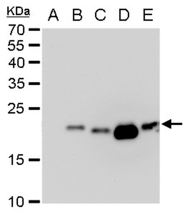 Dengue Virus Type 2 PrM Antibody in Western Blot (WB)