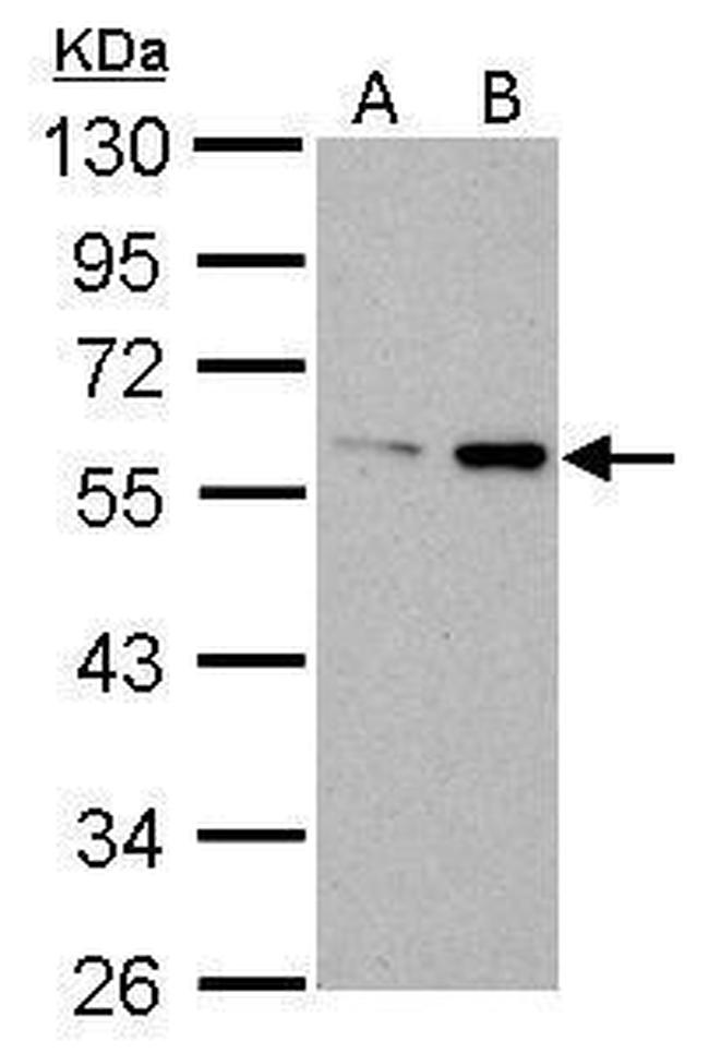 ATG14 Antibody in Western Blot (WB)