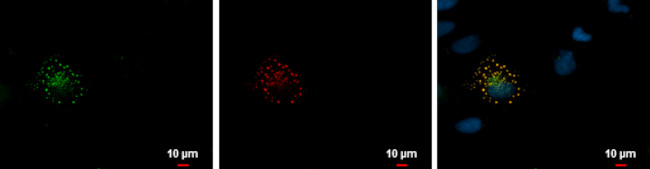 mCherry Antibody in Immunocytochemistry (ICC/IF)