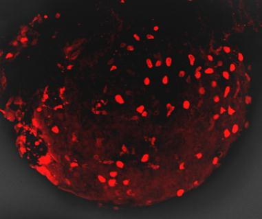 mCherry Antibody in Immunohistochemistry (IHC)