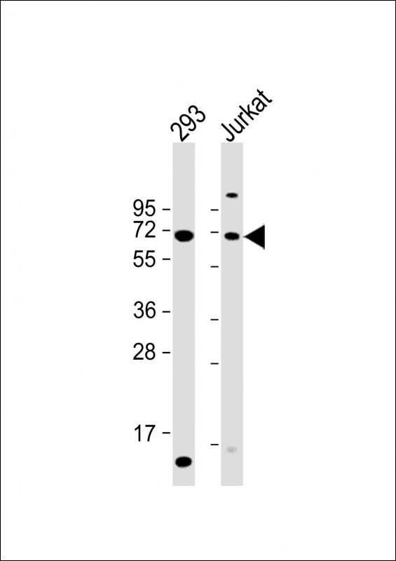 CYP2B6 Antibody in Western Blot (WB)