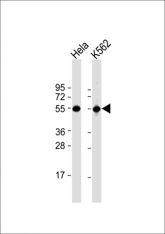 ATP6V1B1 Antibody in Western Blot (WB)