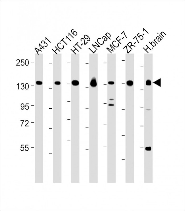 MYO6 Antibody in Western Blot (WB)