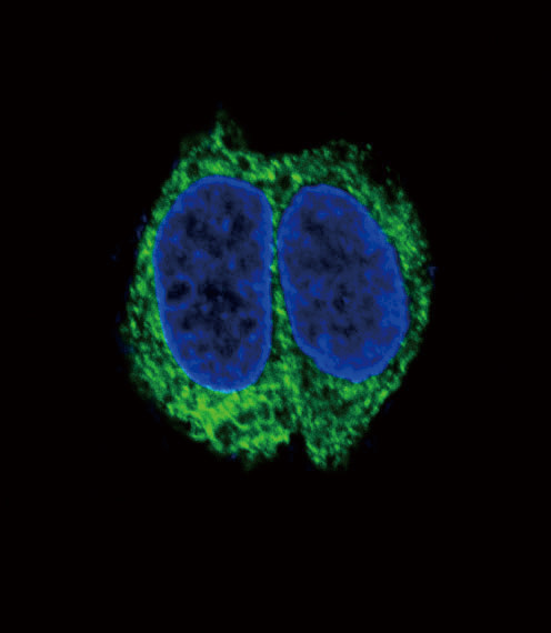 TGFBR2 Antibody in Immunocytochemistry (ICC/IF)