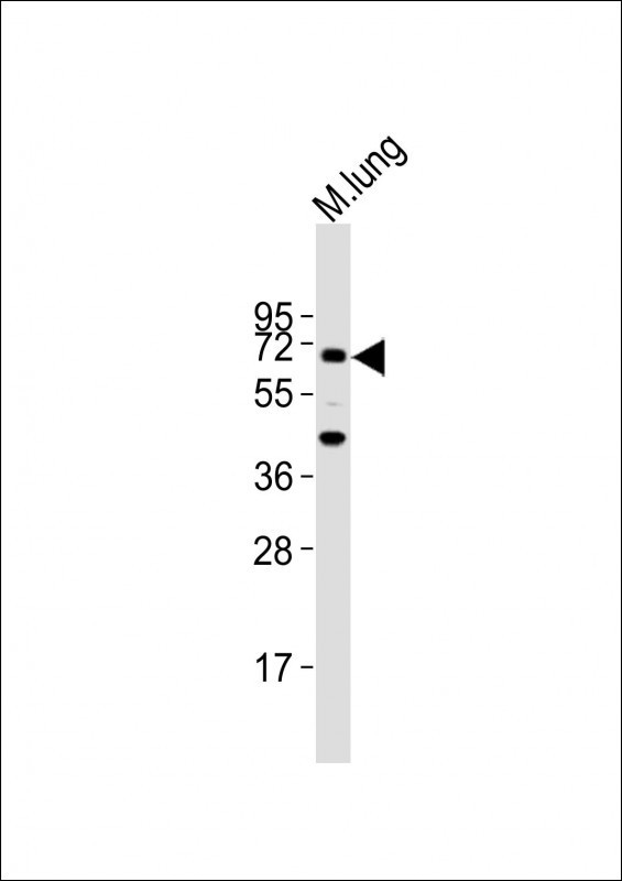 TGFBR2 Antibody in Western Blot (WB)