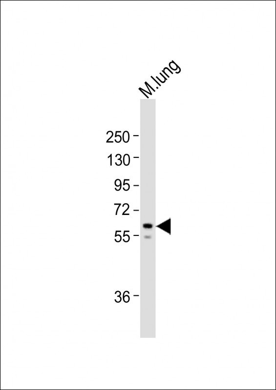 TGFBR2 Antibody in Western Blot (WB)