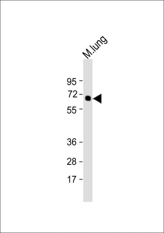 TGFBR2 Antibody in Western Blot (WB)