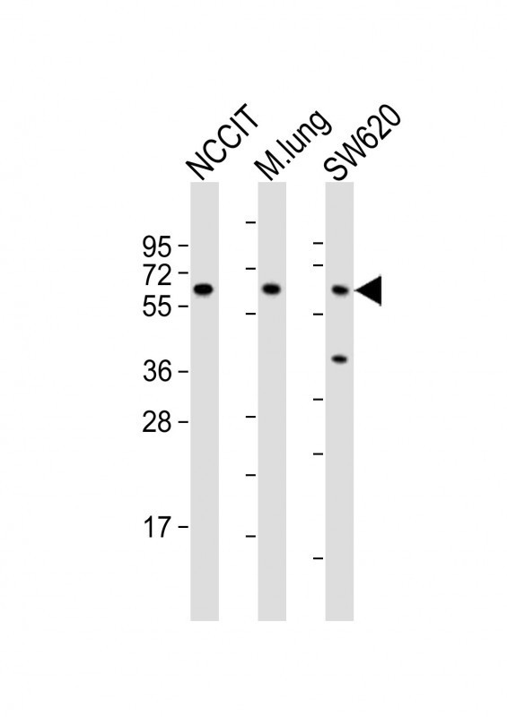 TGFBR2 Antibody in Western Blot (WB)