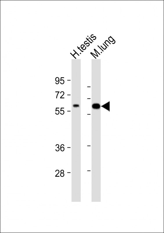 TGFBR2 Antibody in Western Blot (WB)